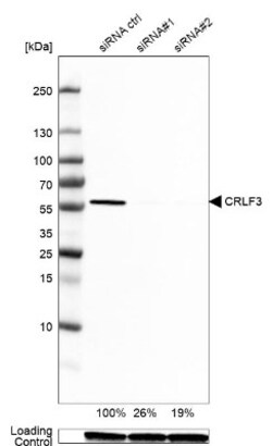 CRLF3 Antibody, Novus Biologicals 0.1mL; Unlabeled:Antibodies, Polyclonal